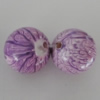 Watermark Acrylic Beads, Round 18mm Hole:2.5mm, Sold by Bag 