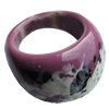 Ceramics Finger Rings, 16mm, Sold by Bag