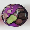 Spray-Painted Acrylic Beads, 32x29mm Hole:2.5mm, Sold by Bag