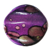 Spray-Painted Acrylic Beads, Twist Flat Round 25x25mm Hole:2mm, Sold by Bag