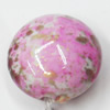 Spray-Painted Acrylic Beads, 17mm, Sold by Bag