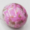 Spray-Painted Acrylic Beads, 12mm, Sold by Bag